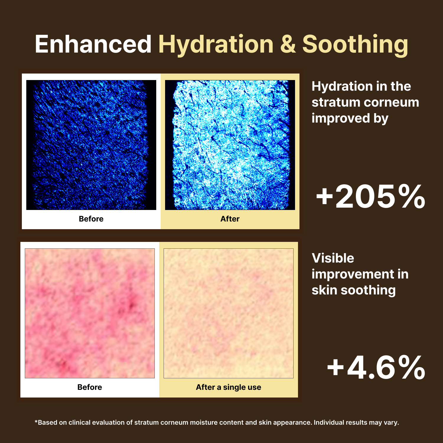 abooba SOOTHAL clinical trial results - hydration, redness reduction, moisture retention, and TEWL improvement